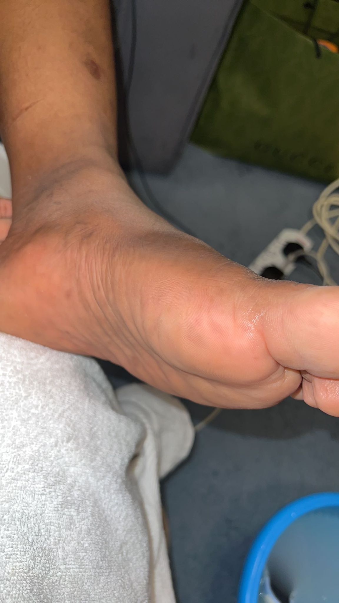 Foot care result side view